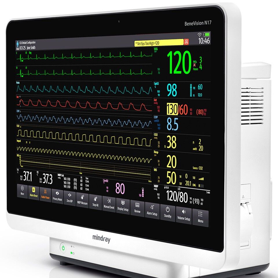 Монитор пациента mindray. Монитор Mindray n12. Монитор пациента BENEVISION n17. Монитор прикроватный Mindray. Mindray BENEVISION n12.